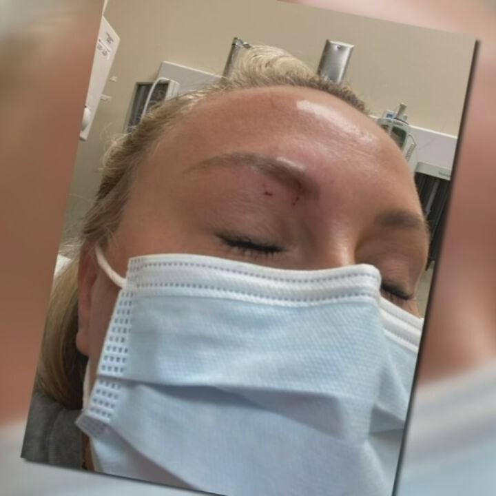 SNAKE BITES KY WOMAN IN FACE - 6-22-2022  (1).jpeg